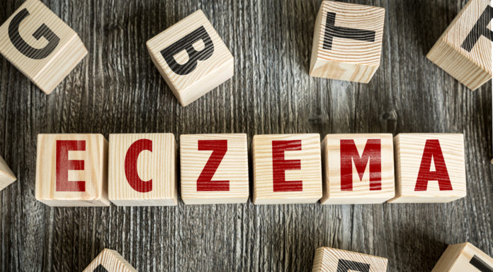 Finding The Best Eczema Treatment For You